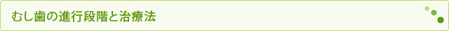 むし歯の進行段階と治療法